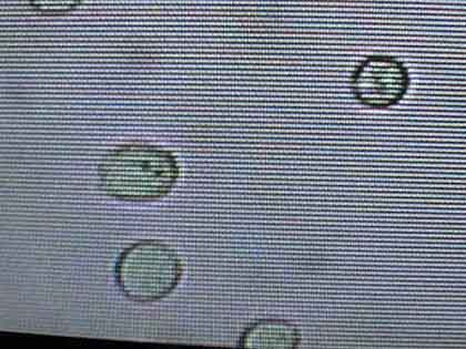 lieviti microscopio.jpg (22000 byte)